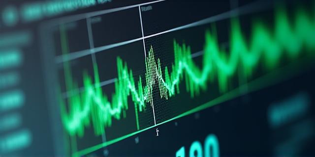 Interface showing real-time data visualization and pulse metrics